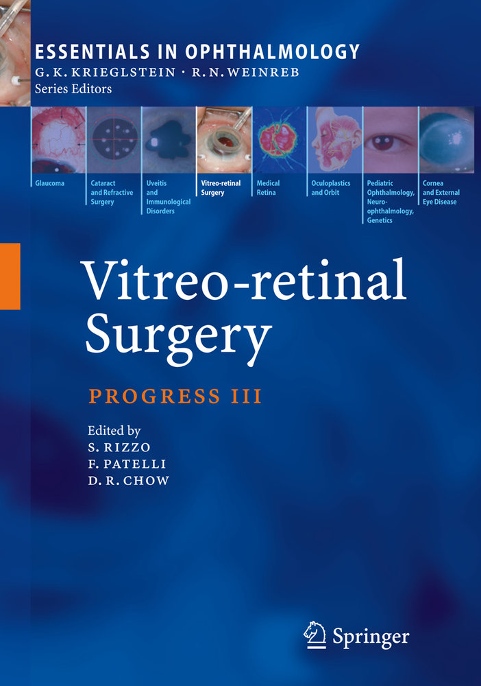 Vitreo-retinal Surgery