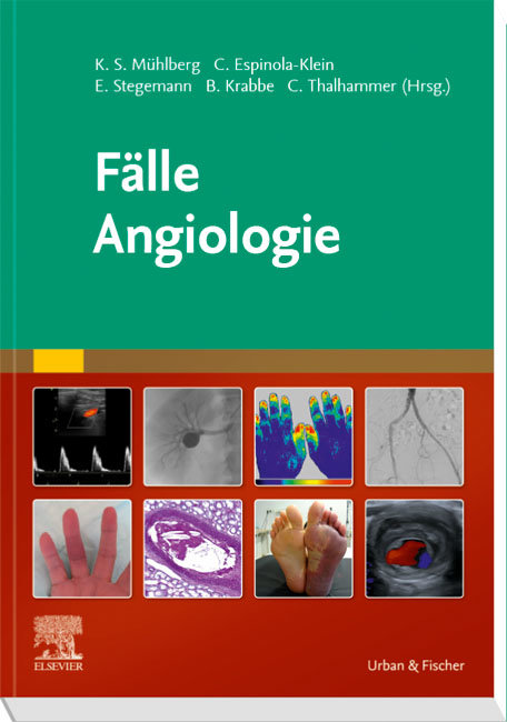 Fälle Angiologie