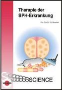 Therapie der BPH-Erkrankung