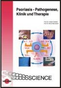 Klinik und Therapie der Psoriasis