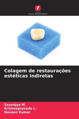 Colagem de restaurações estéticas indiretas